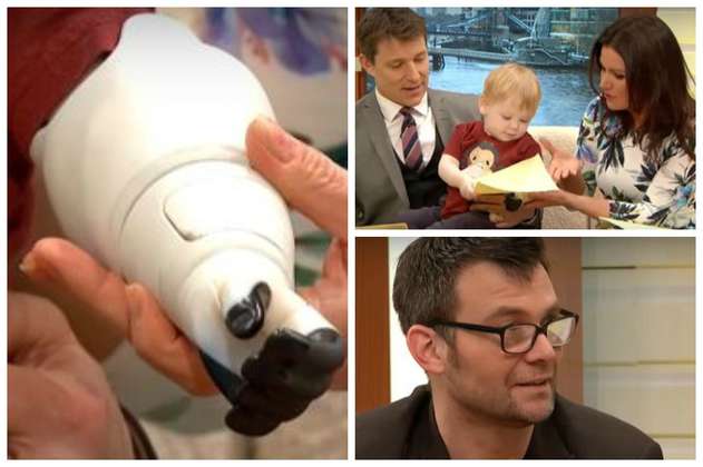Ben Ryan, el papá que diseñó e imprimió una prótesis para su bebé 