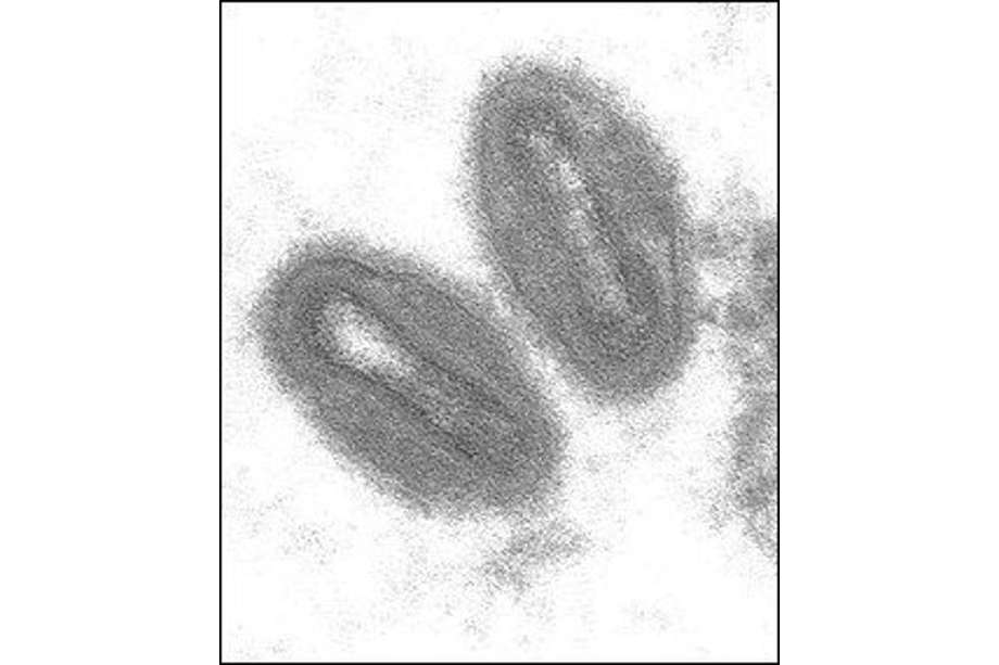 Virus de la viruela del mono.