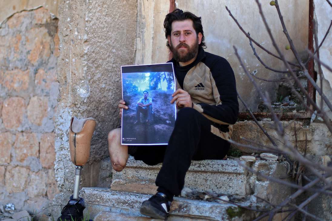 Bakri al-Debs, un médico sirio de 29 años y amputado debajo de la rodilla, posa para una foto en la ciudad de Ihsim, en la provincia de Idlib, noroeste de Siria, controlada por los rebeldes, el 6 de marzo de 2021, mientras sostiene una foto de sí mismo en una pose similar de diez años antes en la Universidad de Tishrin en Latakia, donde estudió Sociología, antes de perder la pierna en un ataque aéreo del gobierno en 2015. Debs dice que cuando estallaron las protestas contra Assad en 2011, fue arrestado varias veces y torturado por fuerzas de seguridad del régimen debido a un caso de confusión de identidad con su primo que comparte el mismo nombre y que encabezó manifestaciones en Ihsim.