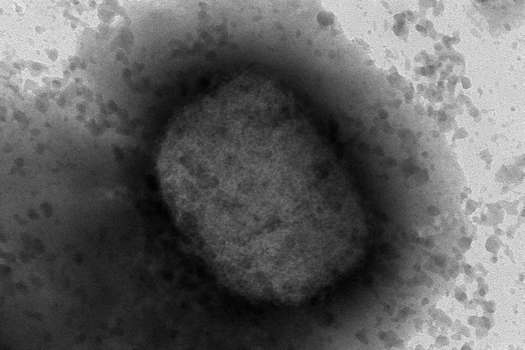 Imagen del virus de la viruela del mono obtenida por microscopía electrónica.
