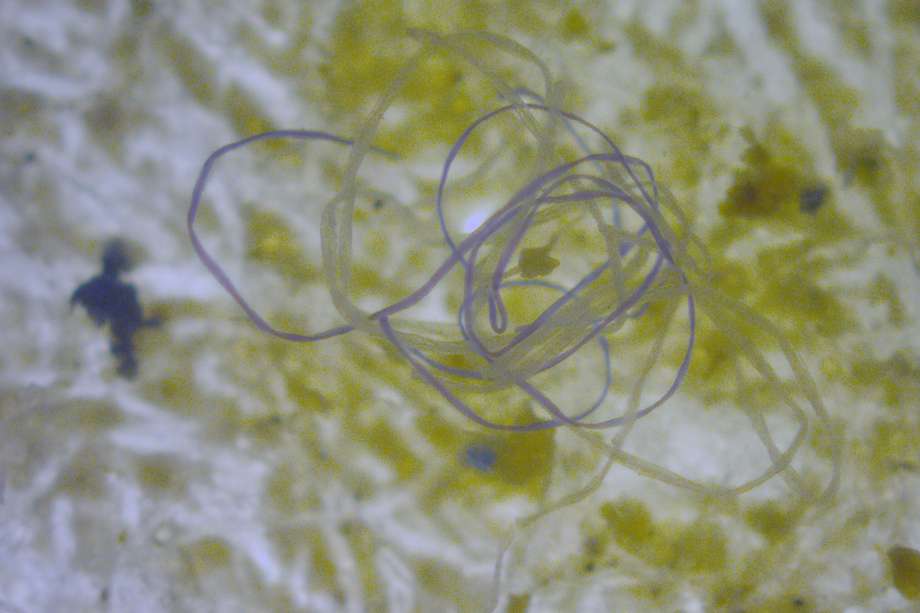 (Imagen de referencia). Un equipo de investigadores de la Universidad de Nuevo México dio a conocer que detectaron microplásticos (partículas de plástico de cinco milímetros o menos) en el tejido testicular, tanto de humanos como de perros.