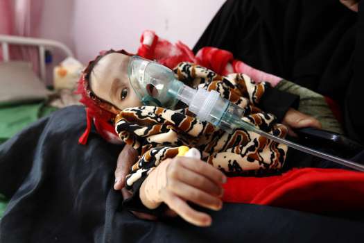 Más de once millones de niños necesitan ayuda humanitaria en Yemen.  / AFP