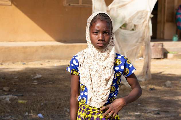 El oeste de África sufre la peor crisis alimentaria en una década