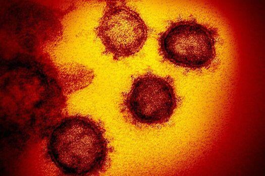 Imagen del nuevo coronavirus SARS-CoV-2 bajo un microscopio electrónico del U.S. National Institutes of Health tomada en febrero de 2020.