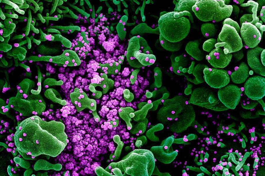 Scan colorizado de células (verde) infectadas con partículas del virus SARS-COV-2 (púrpura). Imagen capturada y colorizada en un laboratorio de la NIAID en Fort Detrick, Maryland