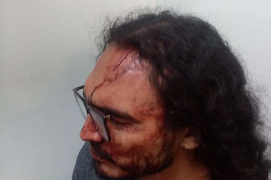 El joven Jhean Karlo Acevedo denuncia violencia policial