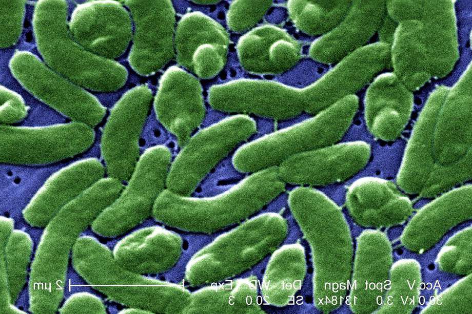 Según los CDC, la agencia nacional de salud pública de Estados Unidos, la mayoría de personas infectadas con la bacteria requieren cuidados intensivos e, incluso, la amputación de las extremidades afectadas. 