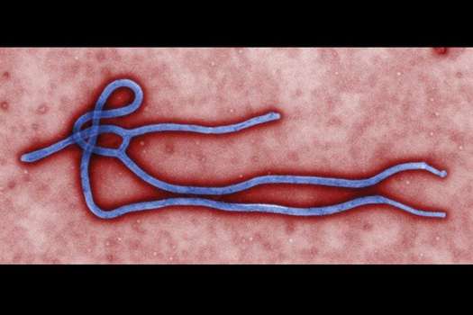Imagen facilitada por el Centro para el Control y Prevención de Enfermedades (CDC) estadounidense que muestra el virus del Ébola. EFE