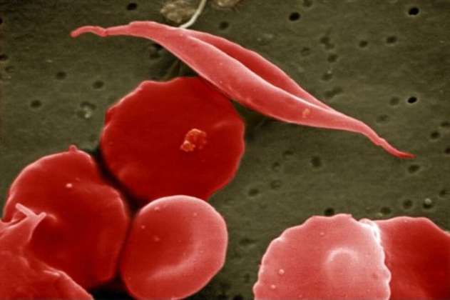 CRISPR/Cas9: laboratorios afirman haber curado pacientes con enfermedades hereditarias de sangre
