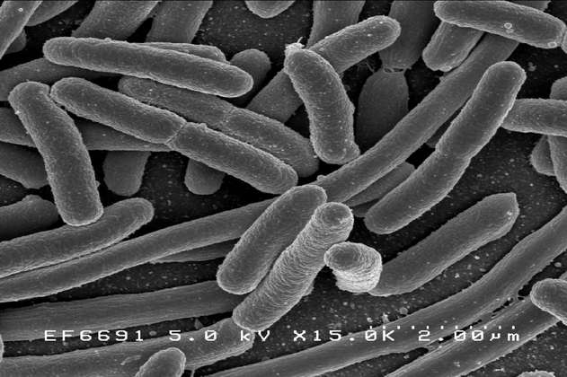 Bacteria transmitida por alimentos genera 480.000 infecciones urinarias en EE. UU.