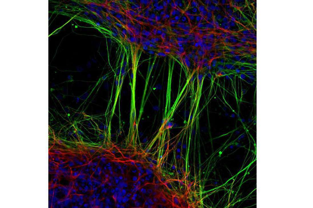 Neuronas humanas derivadas de células madre neurales