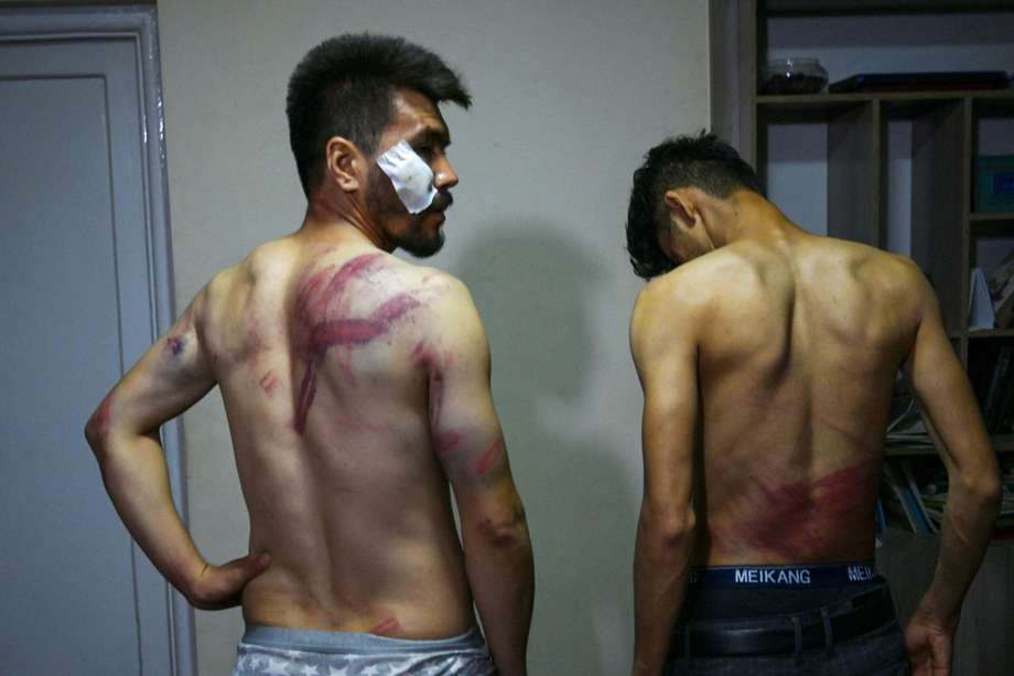 En estos días, varias decenas de periodistas han sido golpeados, detenidos o se les ha impedido cubrir las manifestaciones.