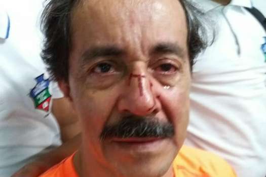 Profesor fue golpeado por el papá de un niño que perdió el año escolar