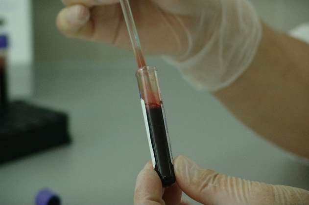 Logran hacer indetectable el VIH en seis pacientes con trasplantes de células madre