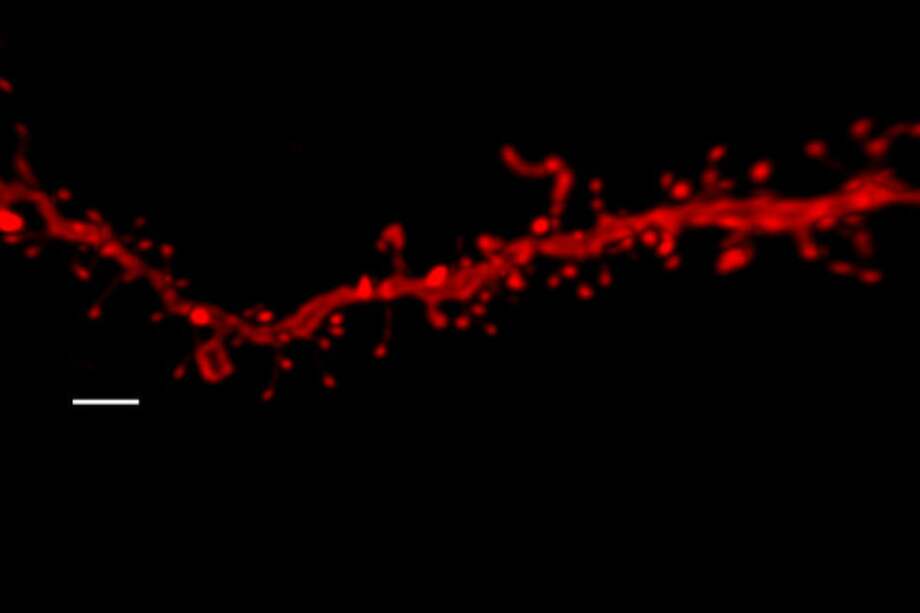 Espinas dendríticas de un animal que ha estado expuesto a THC y estrés. / UPF
