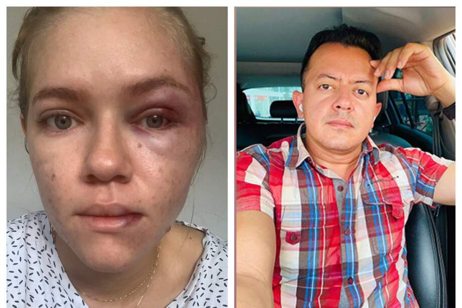 Jhoanna Espejo, ingeniera de la Alcaldía de Ocaña. Deiby Arias, concejal del municipio de Norte de Santander.