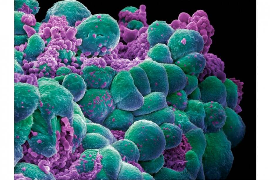 Dos investigadores del hospital Johns Hopkins aseguraron que los tumores aparecen por suerte. / Flickr