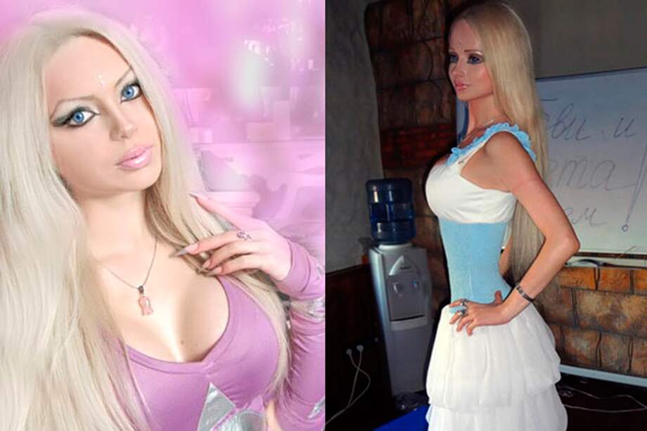 Síndrome de la muñeca Barbie crece en Europa