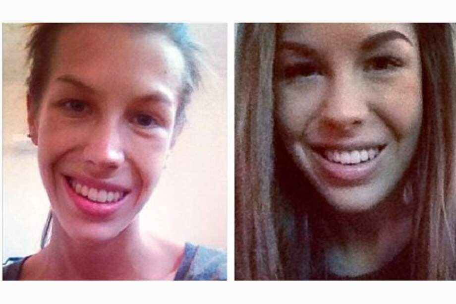 Joven publica en redes sociales su lucha contra la anorexia