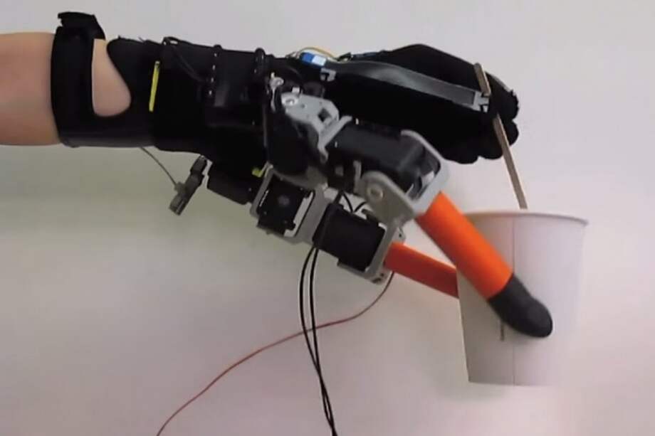 Prótesis robótica le dará dos nuevos dedos a la mano