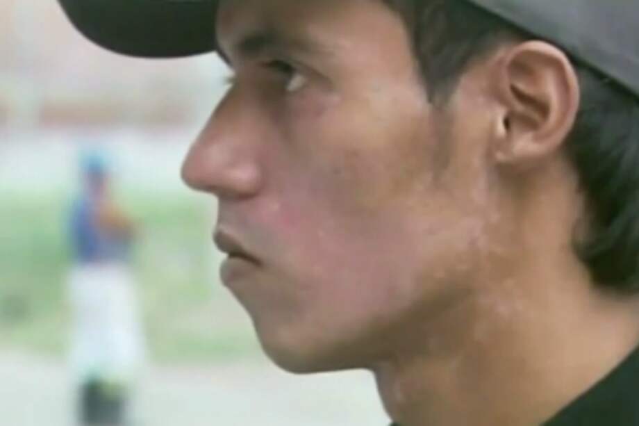 Joven asegura que le quemaron el rostro en estación de Policía