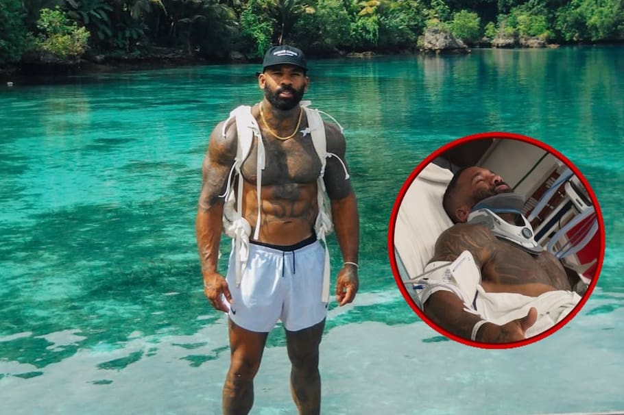 El creador de contenido apareció desde el hospital con parte de su cuerpo vendado. Este es su estado de salud.