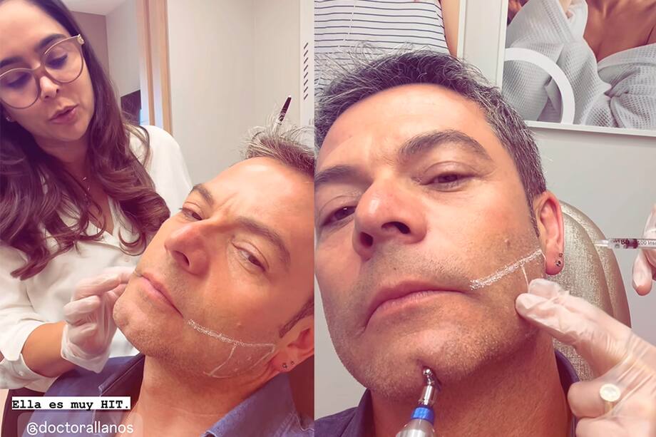 Iván Lalinde, de ‘Día a Día’, se inyectó bótox y mostró el proceso y por qué lo hizo