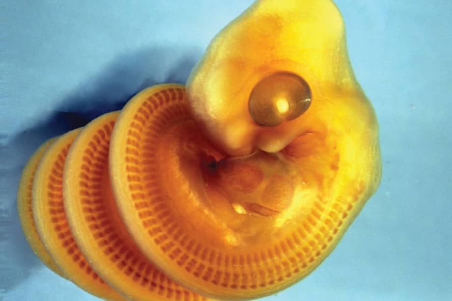 Un embrión de serpiente doméstica del Cabo (Boaedon capensis) teñido para mostrar los bloques musculares en desarrollo del tronco. El embrión presenta una espiral hacia la derecha.
