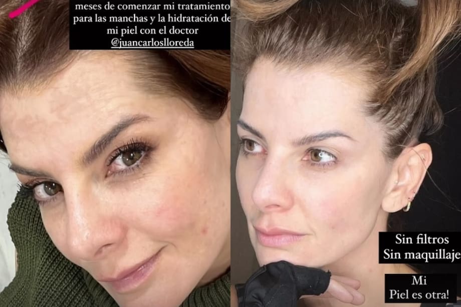 Carolina Cruz compartió con sus seguidores el cambio que ha experimentado en su rostro en los últimos meses.