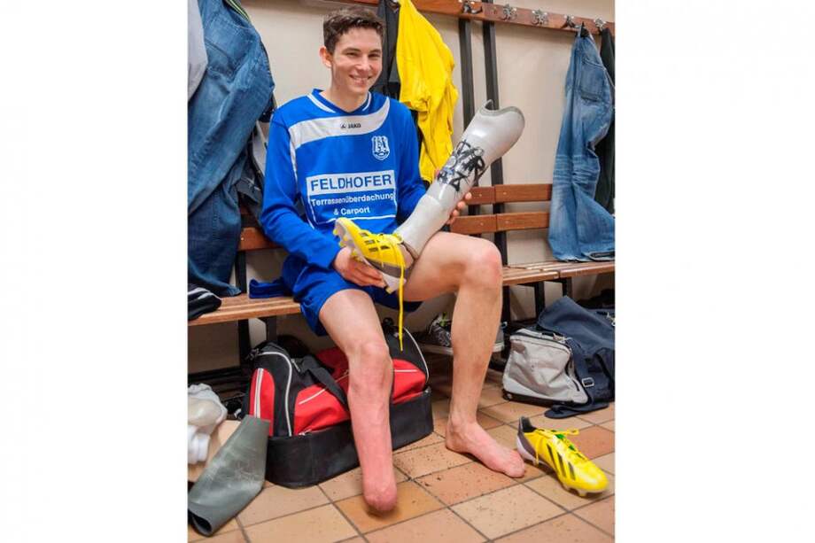 FIFA autoriza a futbolista amputado de una pierna a jugar con prótesis