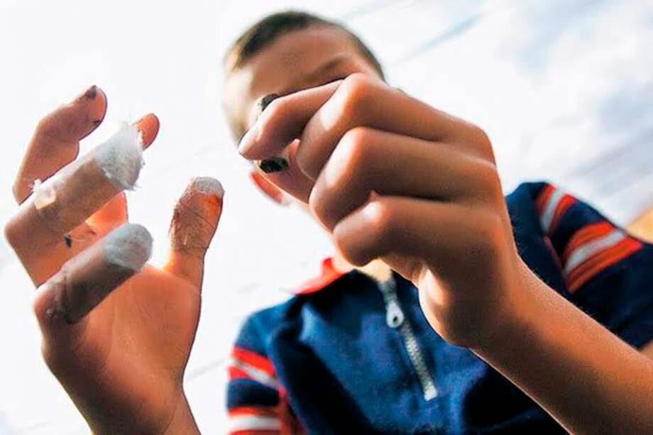 185 niños han resultado quemados con pólvora