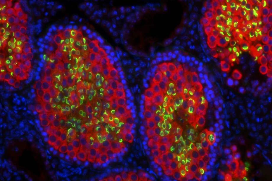 Sección de testículo de quimera ratón-rata fotografiada al microscopio.
