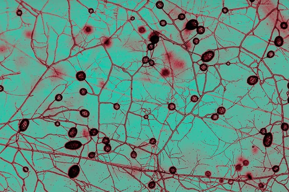 Los investigadores estiman que la capa superficial del suelo a nivel mundial contiene aproximadamente 110 billones de kilómetros de filamentos fúngicos. /Universidad Libre de Ámsterdam.