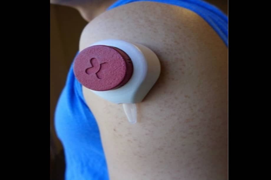 Así sería el dispositivo que extrae sangre de forma indolora. Universidad de Wis / Así sería el dispositivo que extrae sangre de forma indolora. Universidad de Wis