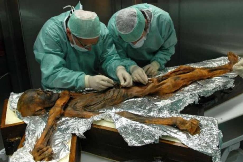 Fotografía facilitada por el Eurac, de Otzi, el hombre de los hielos, mientras un grupo de científicos analiza el contenido de su estómago, que ha revelado que esta momia de 3.500 años de antigüedad tenía una alta muy alta en grasa. / EFE