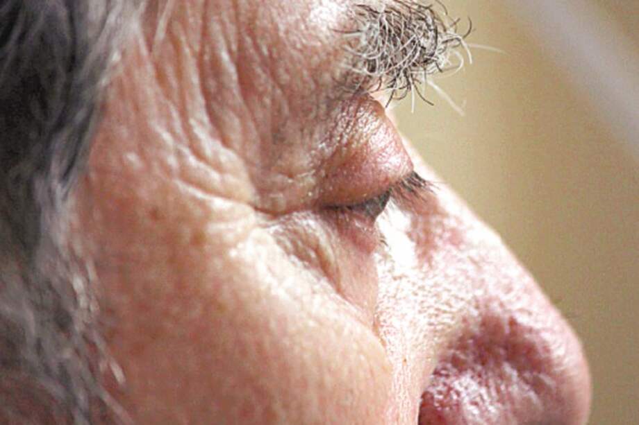 Humanos son los únicos seres vivos que padecen de alzhéimer. / Flickr - Golly Gforce