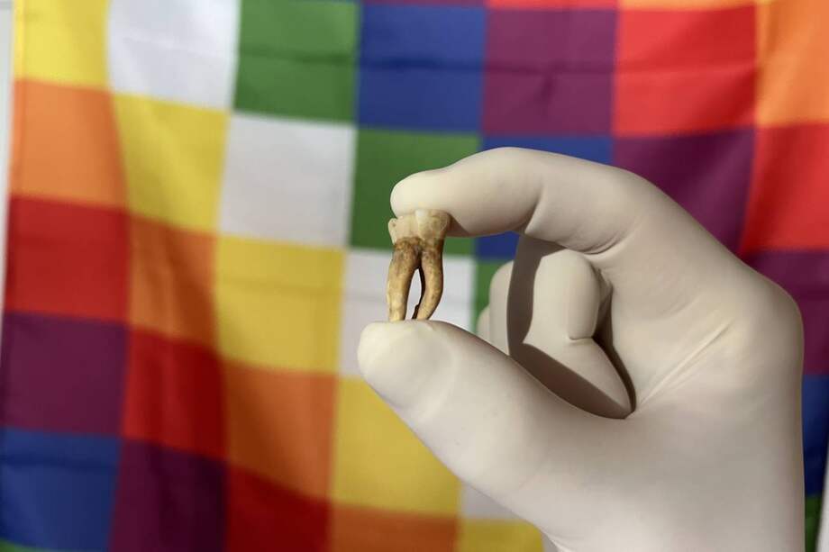 Uno de los dientes utilizados para estudiar el ADN antiguo de la lepra en el continente.