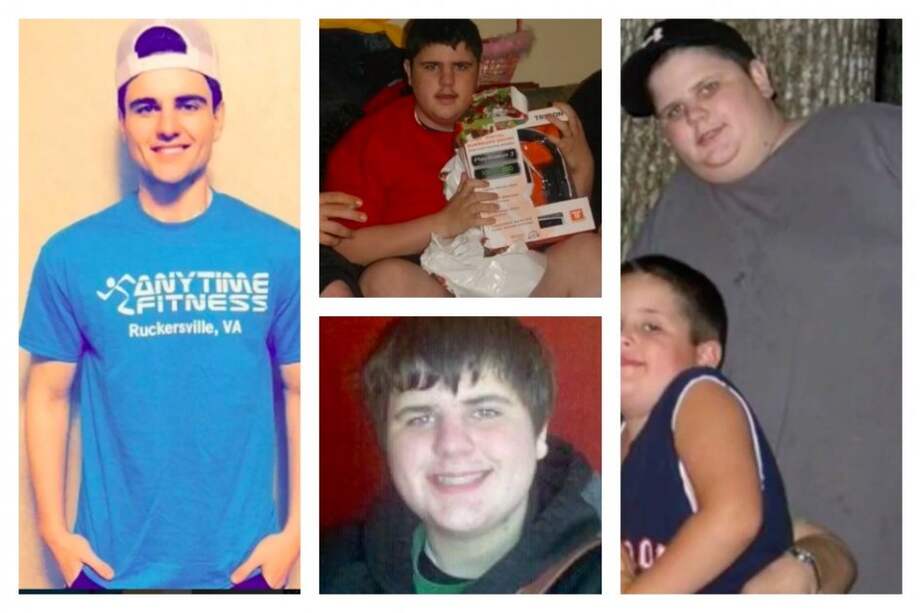 Abismal 'metamorfosis' de un joven que sufría de obesidad mórbida