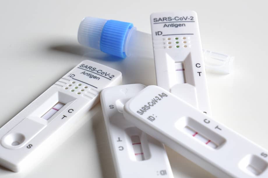 La prueba contiene un hisopo nasal con el que se toma la muestra y los resultados están en 30 minutos.