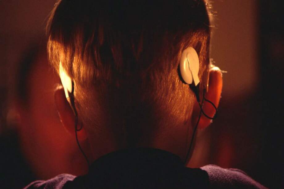 Implantes de cóclea. / MedEd