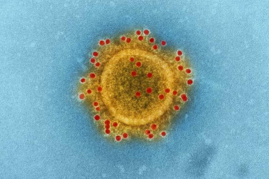 Fotografía de un coronavirus. / Créditos: National Institute of Allergy and Infectious Diseases (NIAID)
