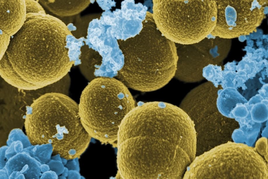 Las bacterias como E. coli, Salmonella y Staphylococcus pueden proliferar si no se limpian de forma adecuada las botellas de agua.