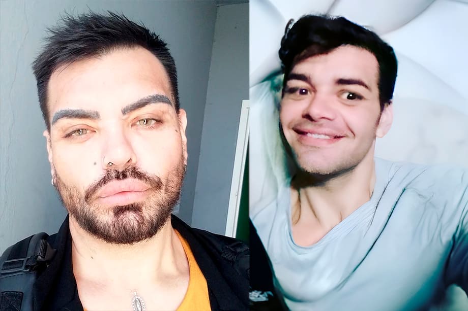 Así se veía (foto de la derecha) antes el modelo que lleva 30 cirugías para parecerse a Ricky Martín