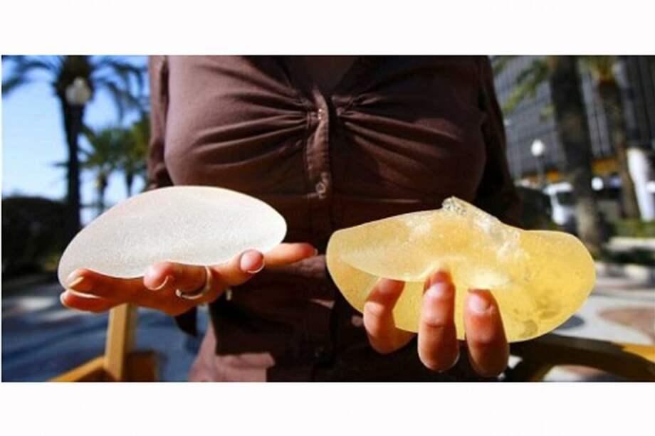 En el Valle se han inscrito 590 mujeres para nueva demanda de implantes PIP