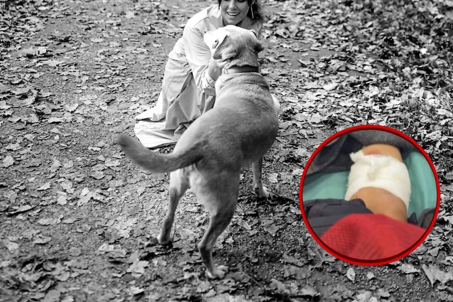 La también presentadora reapareció en un programa de televisión y reveló detalles del momento cuando el canino se abalanzó sobre ella.