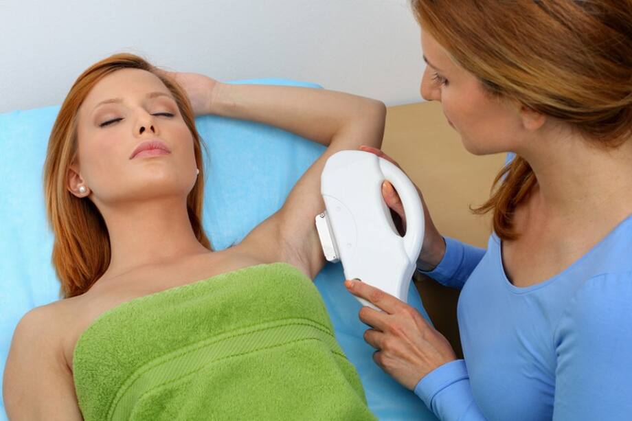 ¿Qué es la depilación IPL?