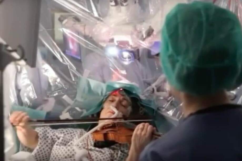 Dagmar Turner, de 53 años, tocó el violín durante una cirugía en su cerebro. / Tomado de video en Youtube.