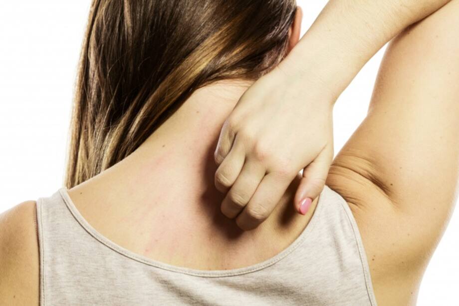 Dermatitis, el enemigo de la piel