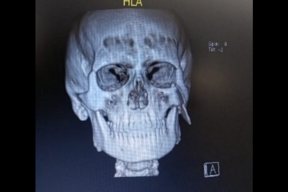 Secretaría de Salud