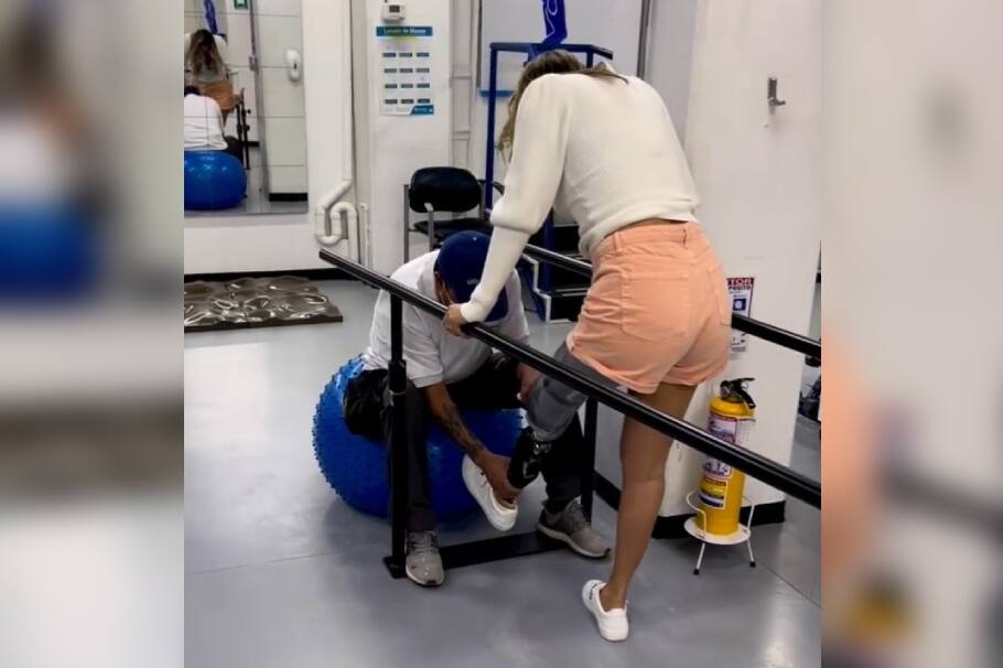 Daniela Álvarez apareció en redes hablando de su prótesis y de un error que cometió con uno de los elementos que usa.